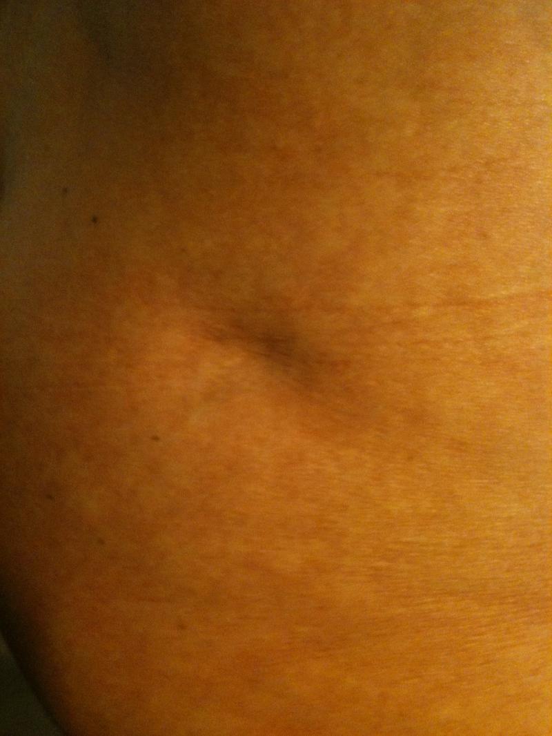 hole before